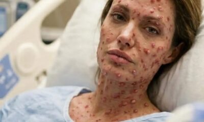 💔 HEARTBREAKING NEWS: Angelina Jolie Rushed to Hospital With a “Severe” Illness — Doctors Admit They’ve Never Seen a Case Like This Before… 😭 🔔 Read more :