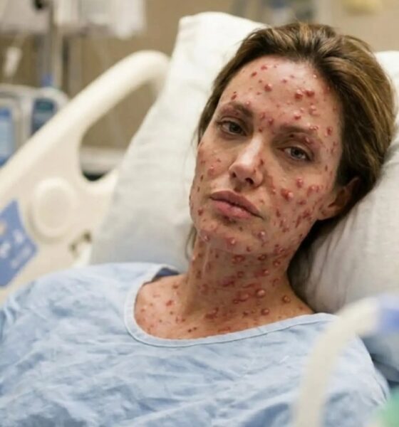💔 HEARTBREAKING NEWS: Angelina Jolie Rushed to Hospital With a “Severe” Illness — Doctors Admit They’ve Never Seen a Case Like This Before… 😭 🔔 Read more :